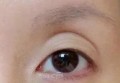 怎样丰眼窝？