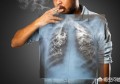 细菌性肺炎和病毒性肺炎怎么判断？